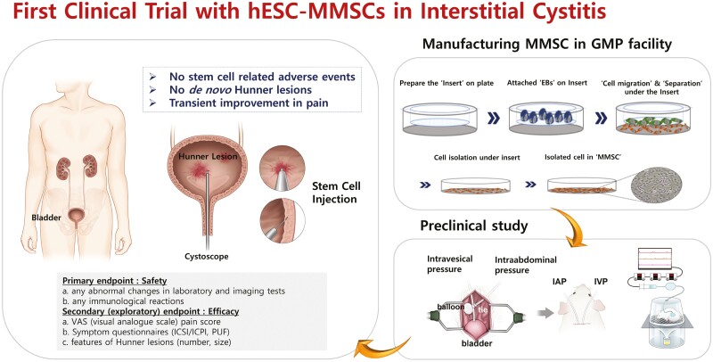 韓國首爾醫(yī)院公布：干細胞治療間質(zhì)性膀胱炎的I期臨床試驗研究結(jié)果