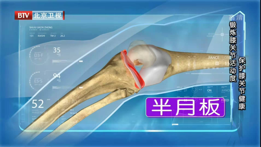 干細胞治療半月板損傷臨床試驗患者招募！