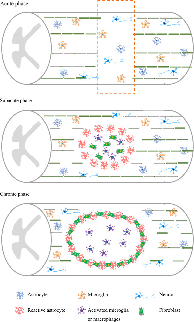 圖1：脊髓損傷不同階段的病理特點。