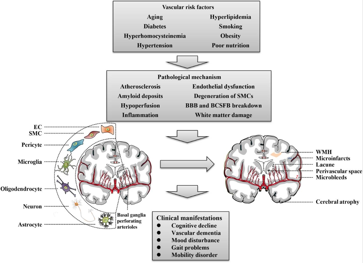 圖1：腦小血管病概述