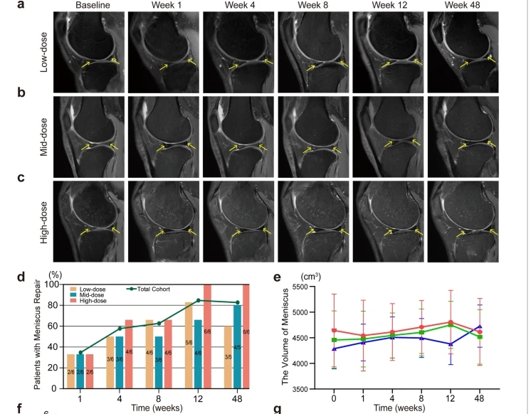 a – c不同劑量組膝關(guān)節(jié) MRI 掃描中的半月板損傷。d半月板修復(fù)患者百分比。e注射后六個(gè)時(shí)間點(diǎn)的半月板體積分析。
