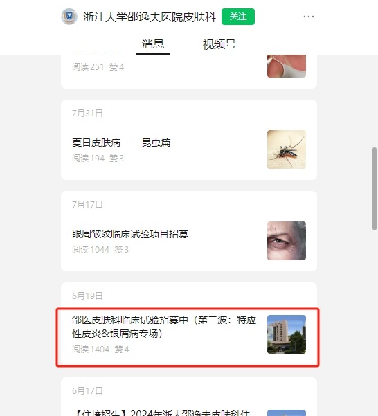 干細胞臨床招募：邵逸夫醫(yī)院招募特應性皮炎濕診患者參與治療！