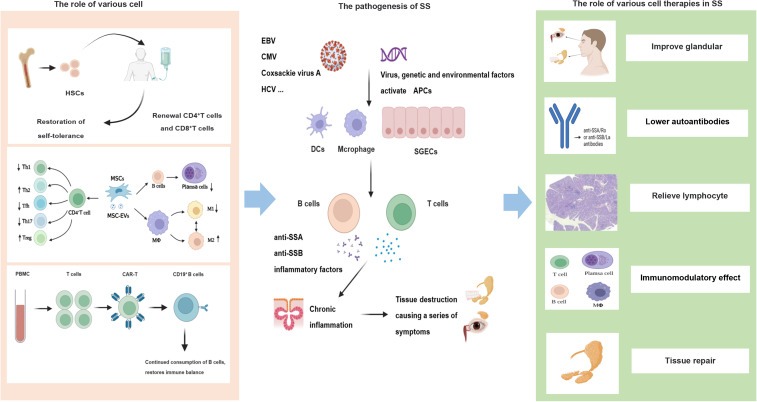 圖1：干燥綜合征的發(fā)病機(jī)制和細(xì)胞治療