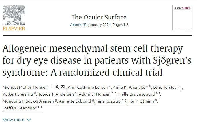 同種異體間充質(zhì)干細(xì)胞治療干燥綜合征患者干眼癥：一項(xiàng)隨機(jī)臨床試驗(yàn)
