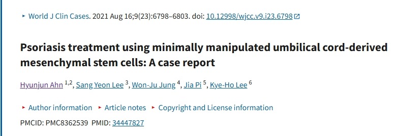 使用微操作臍帶來(lái)源的間充質(zhì)干細(xì)胞治療銀屑?。翰±龍?bào)告