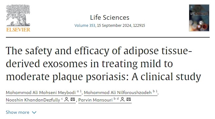 脂肪組織衍生外泌體治療輕中度斑塊狀銀屑病的安全性和有效性：一項(xiàng)臨床研究
