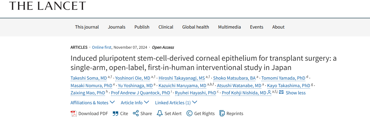 《誘導(dǎo)性多能干細(xì)胞來(lái)源的角膜上皮用于移植手術(shù)：日本的一項(xiàng)單臂、開(kāi)放標(biāo)簽、首次人體介入研究》