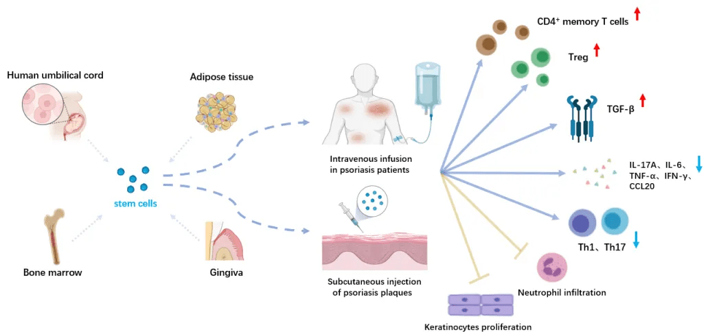 圖3：干細(xì)胞在銀屑病治療中的應(yīng)用