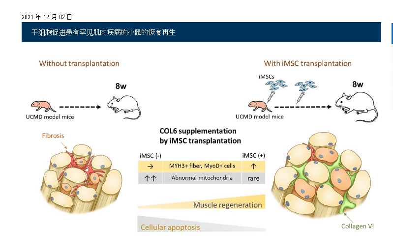 2021年干細(xì)胞治療肌肉萎縮癥臨床案例