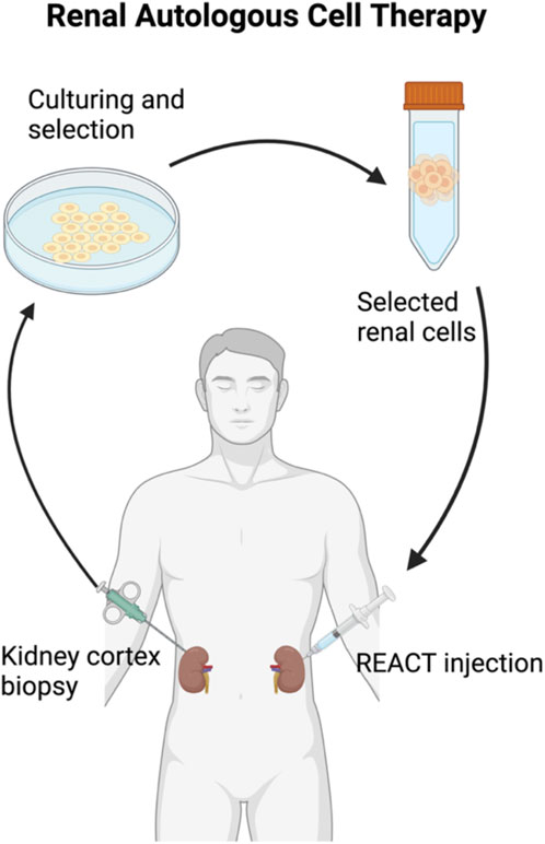 圖2：自體細(xì)胞治療腎臟疾病