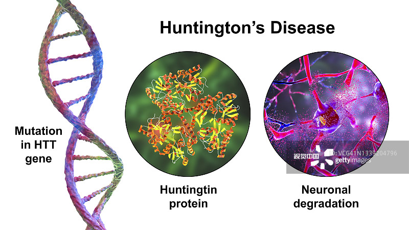 亨廷頓氏病，概念性說明