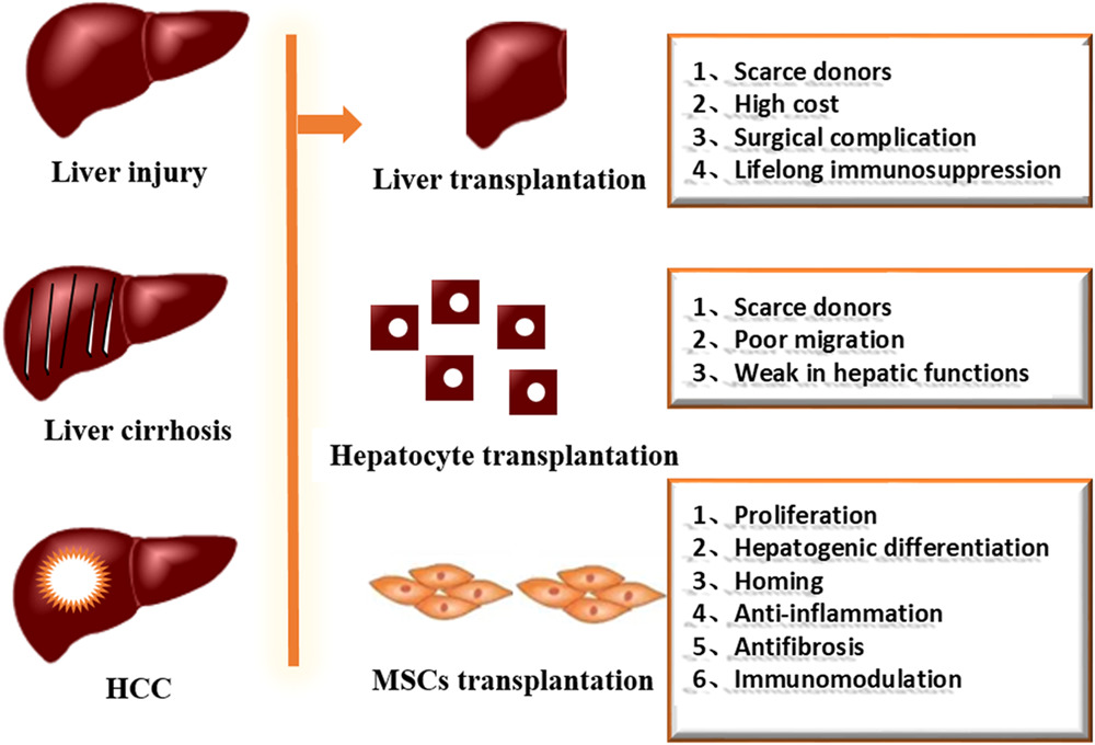 間充質干細胞治療肝損傷的臨床研究進展