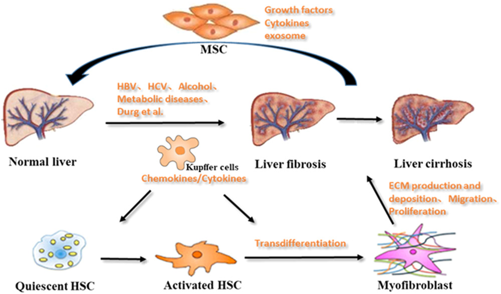 肝纖維化的形成機制