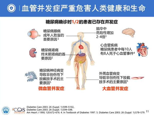 間充質(zhì)干細胞治療糖尿病并發(fā)癥