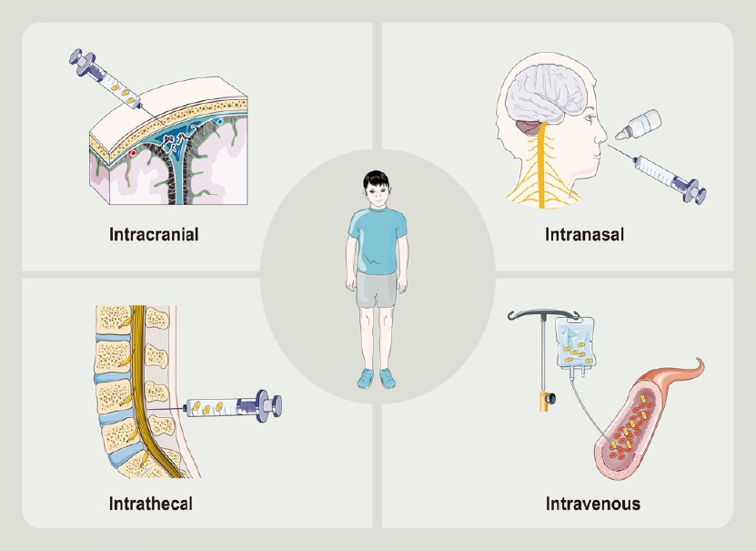 圖2：腦癱患者干細胞治療的常見給藥途徑?