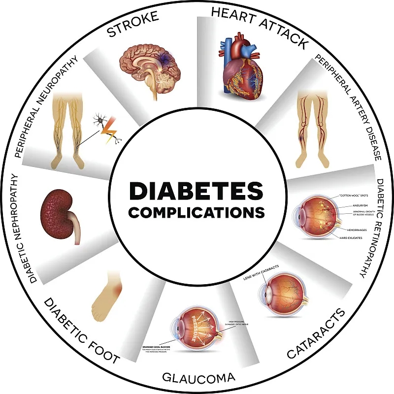 2型糖尿病并發(fā)癥和如何預防這些并發(fā)癥