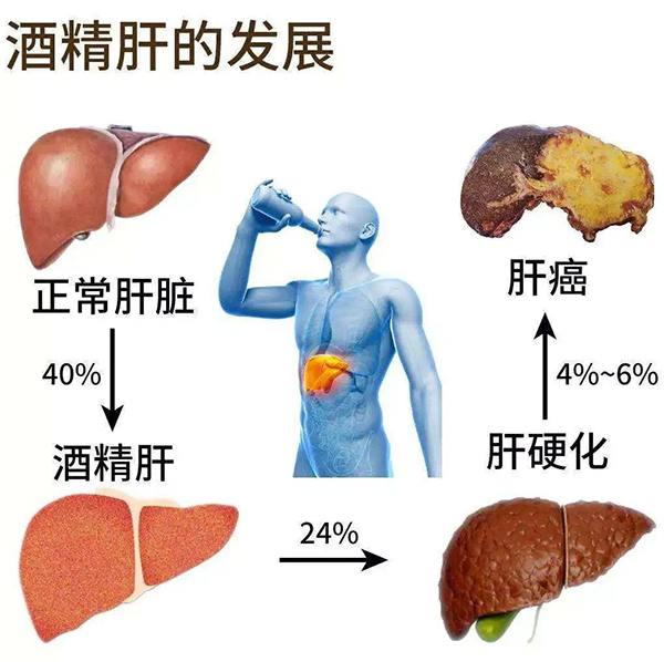 酒精相關肝病的癥狀