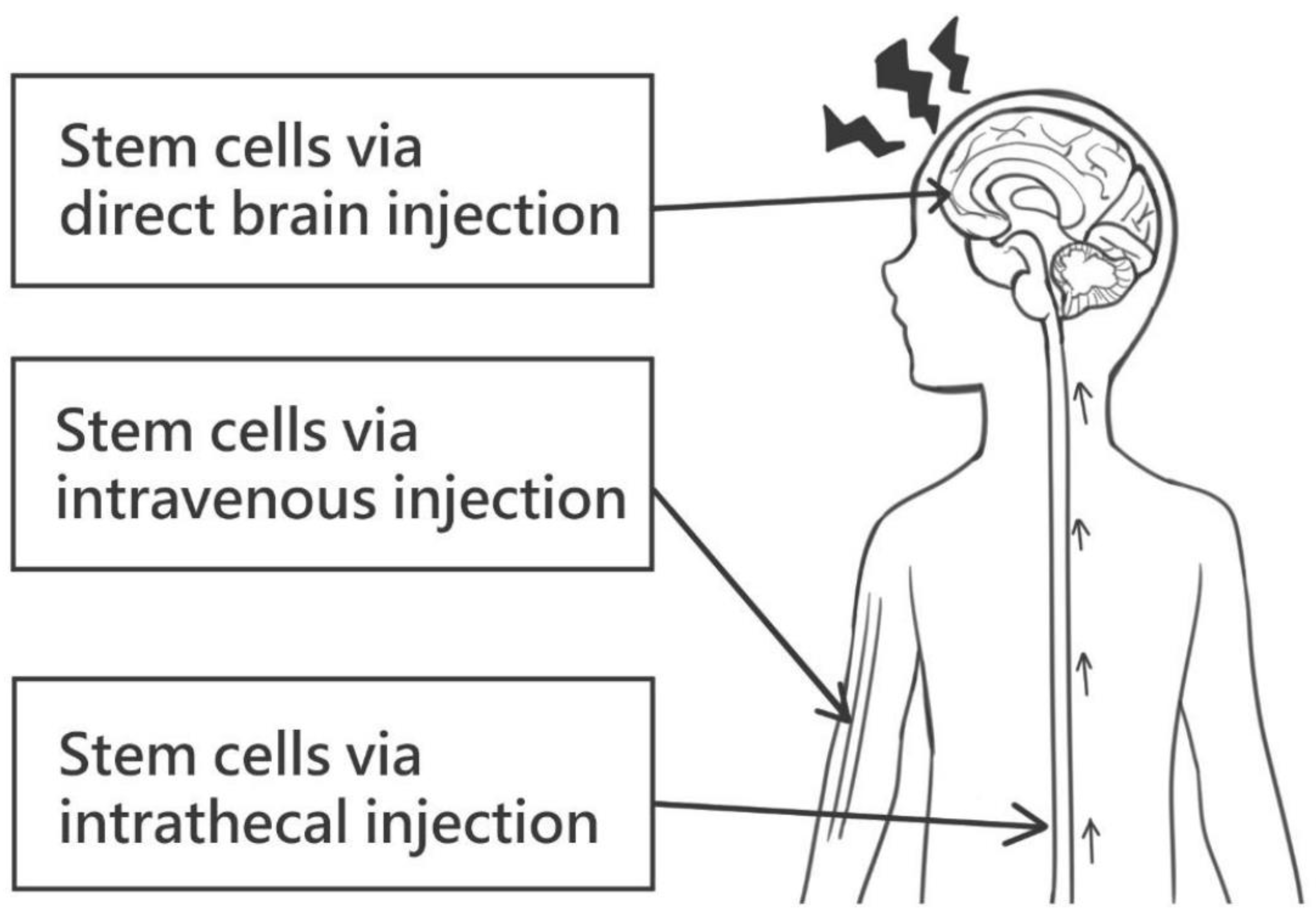 圖1：干細(xì)胞給藥的各種途徑。這些可能包括直接腦注射、靜脈注射和鞘內(nèi)注射。