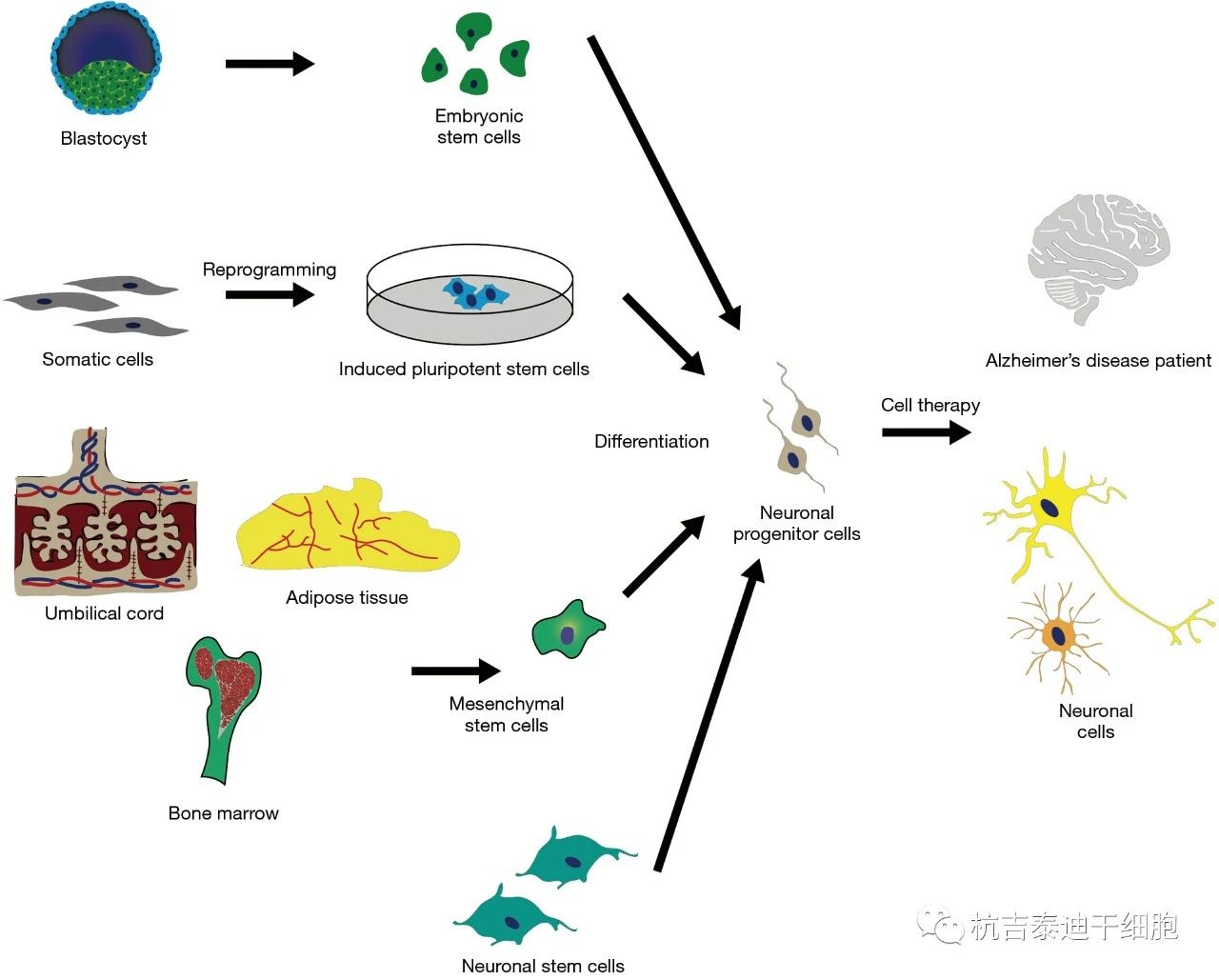 圖1：干細胞療法起源于目前用于治療阿爾茨海默病的各種來源。