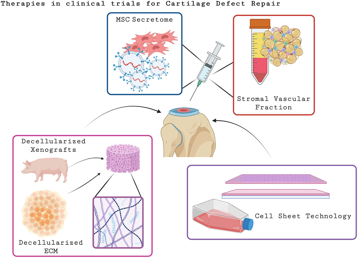 圖2.目前正在進(jìn)行軟骨缺損再生臨床試驗(yàn)的療法示意圖
