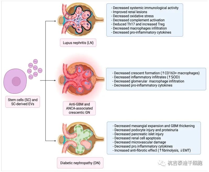 干細胞和EV作為原發(fā)性腎小球腎炎的治療工具