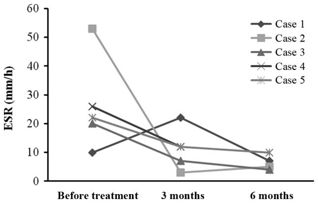 圖3:每位患者在治療前后的ESR。3例患者血沉明顯下降
