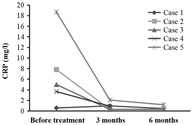 圖4：每位患者治療前后的CRP水平。1名患者的CRP水平降低，而其他4名患者的CRP水平保持穩(wěn)定并在正常范圍內(nèi)。