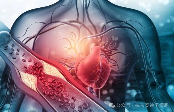 通過干細(xì)胞治療改善心血管疾病的5個簡單步驟