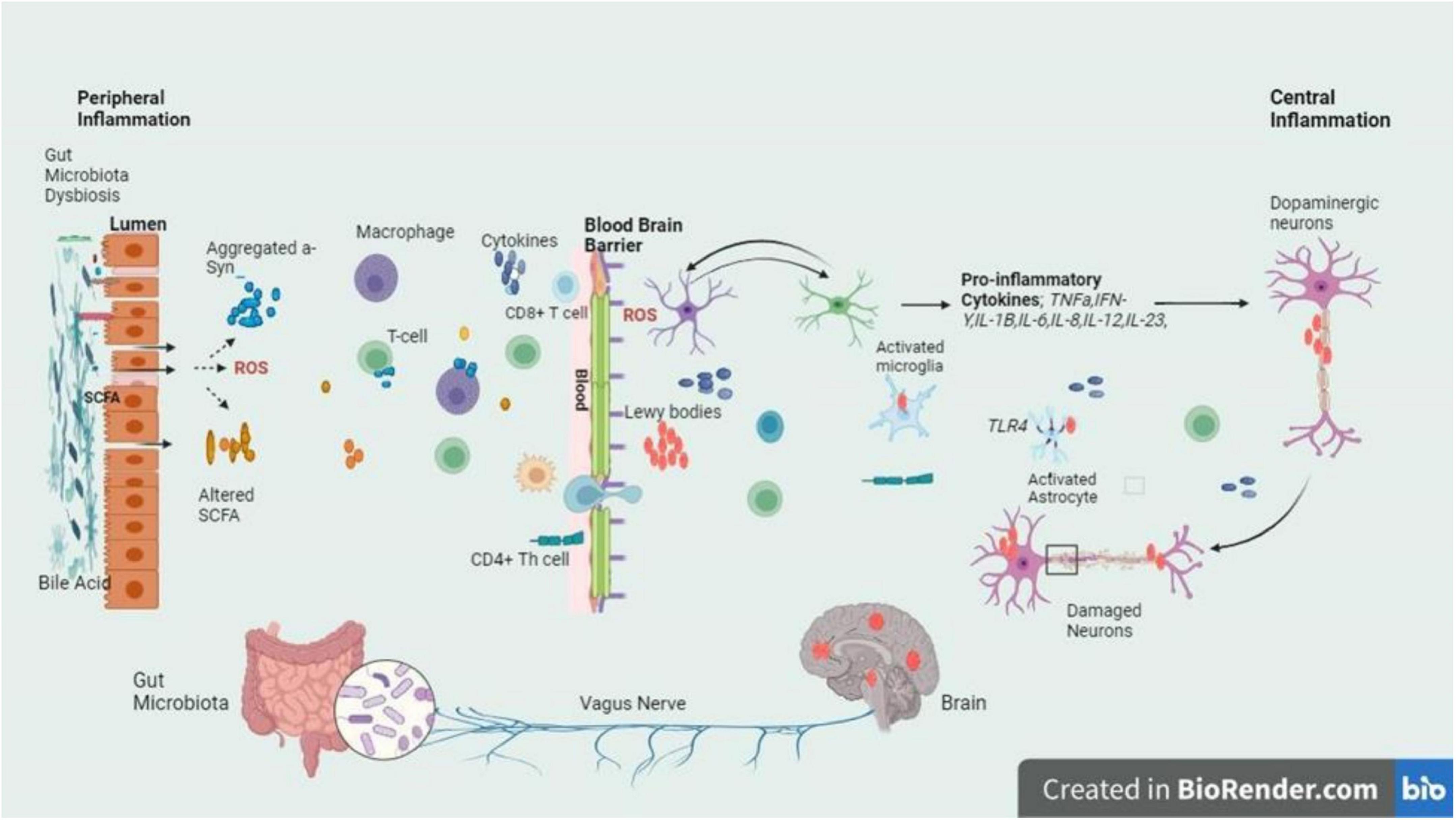 圖3：圖中的信號通路描繪了帕金森病腸道軸和大腦軸之間錯綜復(fù)雜的關(guān)系，重點是腸道內(nèi)腔和BBB的菌群失調(diào)引發(fā)的炎癥級聯(lián)反應(yīng)