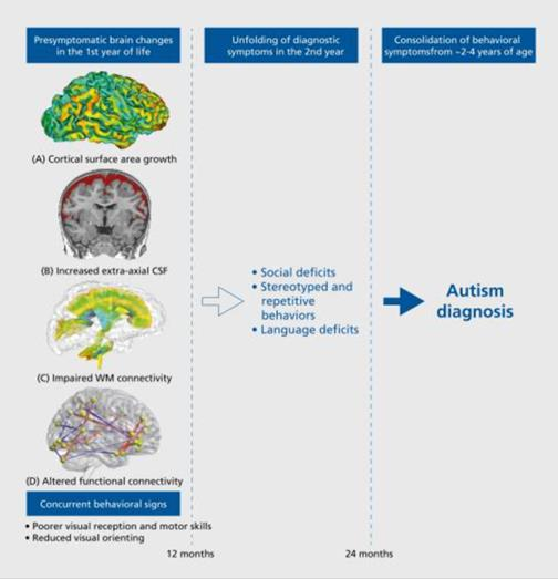 圖1：在出現(xiàn)典型自閉癥譜系障礙之前，自閉癥譜系障礙的可觀察大腦特征癥狀