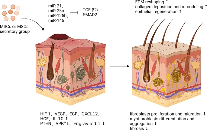 圖6：間充質(zhì)干細胞促進皮膚疤痕修復(fù)的機制。