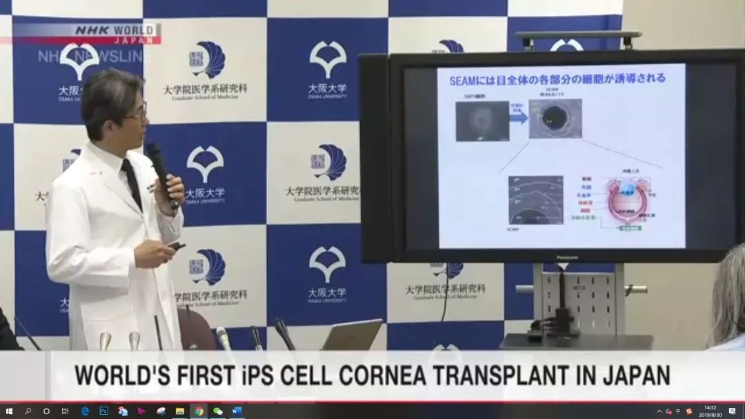 干細(xì)胞治療角膜疾病臨床案例