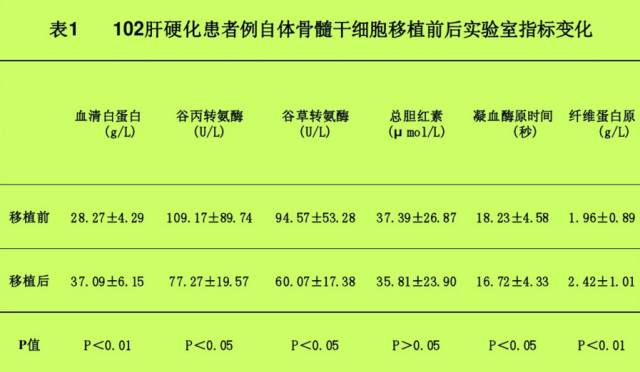 自體骨髓干細胞移植治療肝硬化102例報告。