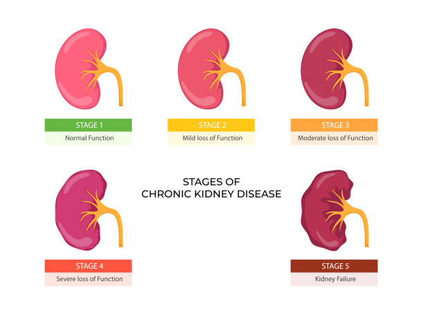 慢性腎病治療新希望：干細胞治療慢性腎病的臨床應(yīng)用與效果評估