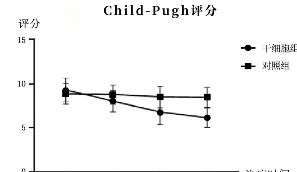 2005年干細(xì)胞治療肝硬化臨床案例