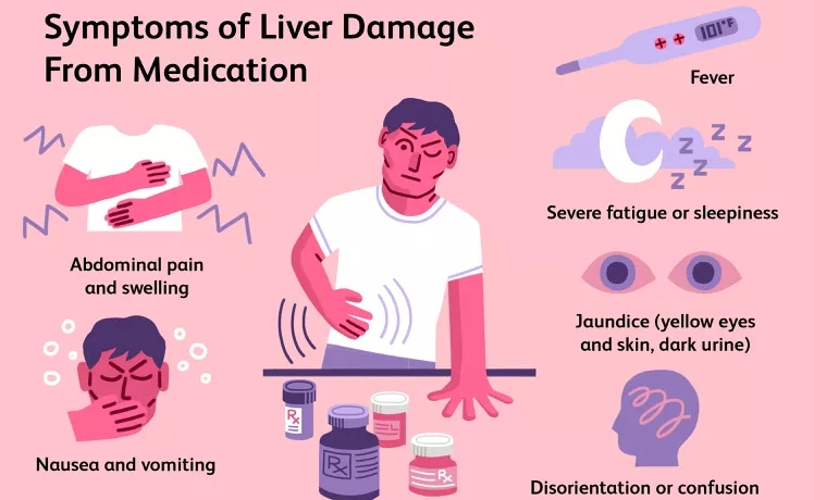 藥物導(dǎo)致肝衰竭的早期跡象