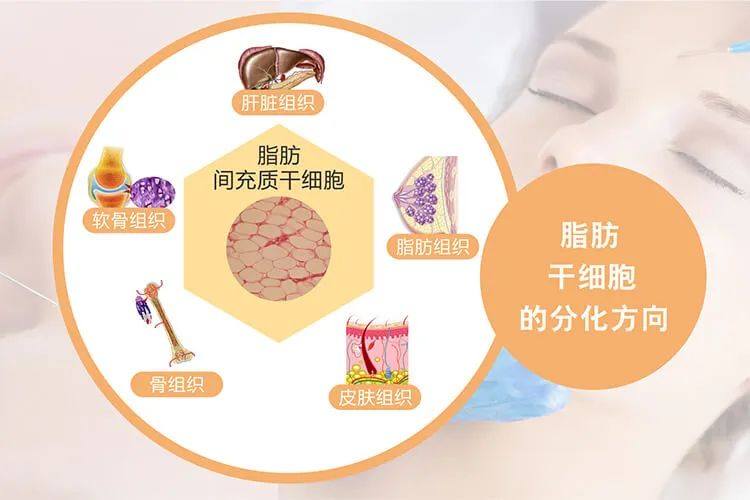 什么是脂肪干細(xì)胞：脂肪干細(xì)胞來源、臨床應(yīng)用