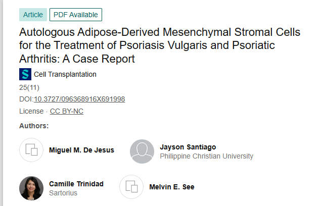 2016年菲律賓馬尼拉大都會(huì)馬卡蒂醫(yī)療中心國(guó)際在期刊《Cell Transplantation》發(fā)布了一篇《自體脂肪來(lái)源的間充質(zhì)基質(zhì)細(xì)胞治療尋常型銀屑病和銀屑病關(guān)節(jié)炎：病例報(bào)告》的研究結(jié)果。