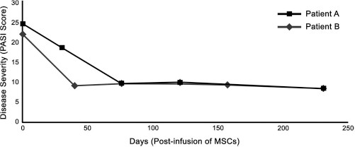 圖 1?. 移植 MSCs 前后兩例患者的銀屑病面積和嚴(yán)重程度指數(shù) (PASI) 評(píng)分總結(jié)。在輸注 MSCs 后的隨訪中，每例患者的 PASI 評(píng)分均有所下降。評(píng)分由第三方皮膚科醫(yī)生進(jìn)行。臨床改善持久，患者 A 的改善持續(xù)超過 150 天，患者 B 的改善持續(xù)超過 200 天。