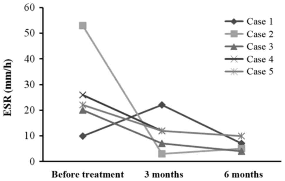 每位患者治療前后的 ESR。3 位患者的 ESR 明顯下降。ESR，紅細胞沉降率。