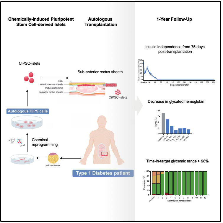 圖1：基于CiPS細(xì)胞治療1型糖尿病的臨床研究的示意圖和治療效果