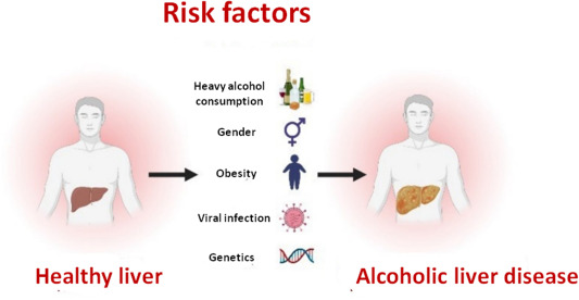 酒精性肝病風(fēng)險(xiǎn)因素