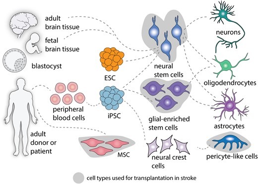 圖2：中風(fēng)后細(xì)胞治療的細(xì)胞類型。