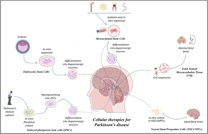 圖1：帕金森病的細胞療法：胚胎干細胞 (ESC)、誘導(dǎo)性多能干細胞 (iPSC)、間充質(zhì)干細胞 (MSC)、神經(jīng)干細胞/祖細胞 (NSC/NPS) 是帕金森病的新興候選藥物。